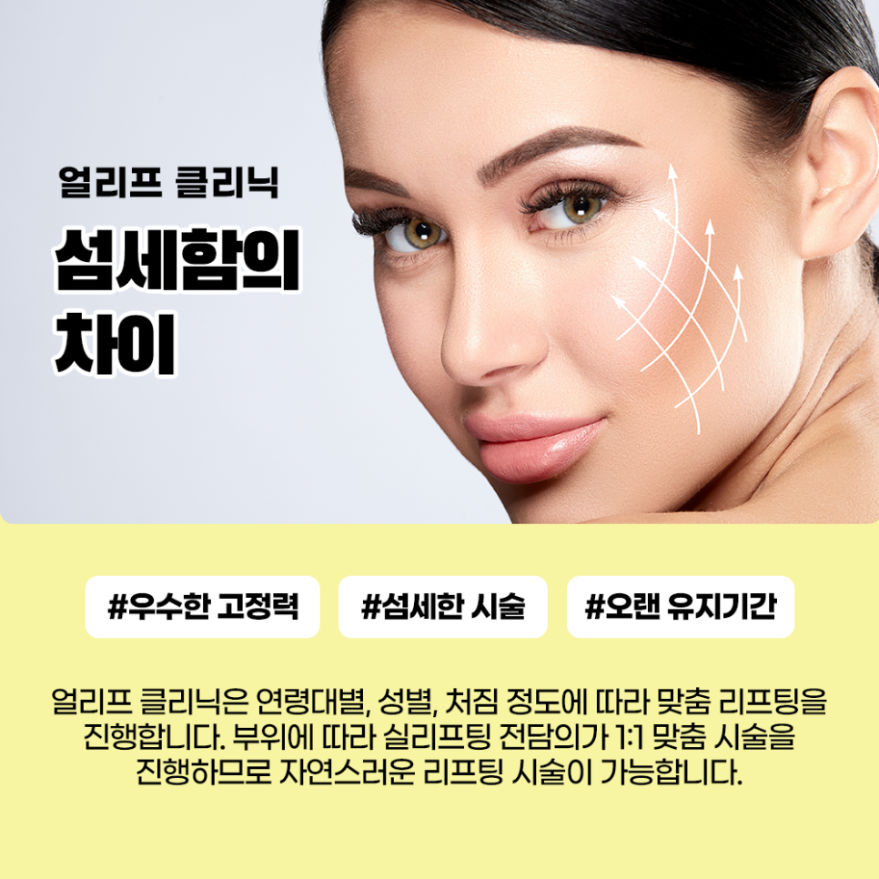 The Effects of Thread Lifting That Make You Look 10 Years Younger and Who It’s Recommended For, a Procedure Many Celebrities Also Do image 5