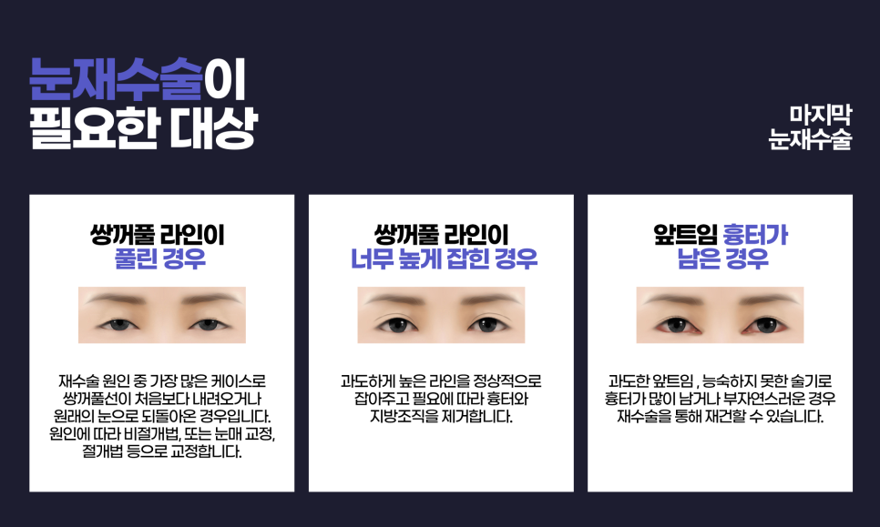 Because Revision Eye Surgery Is More Difficult Than the First, Start at April 31 Plastic Surgery image 4