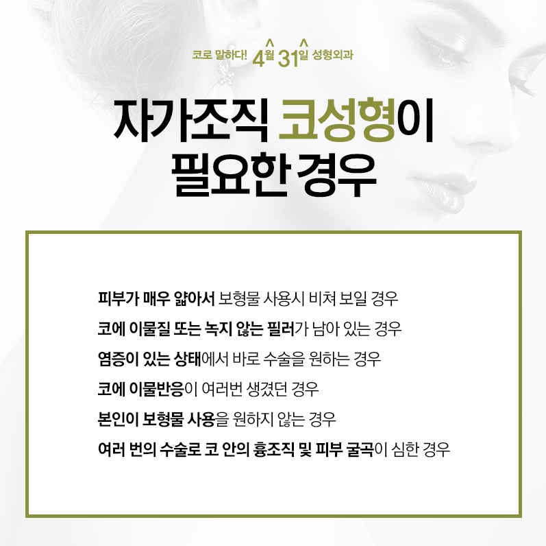 무보형물자가조직코성형 자연스럽게 4월31일성형외과 관련 이미지 6