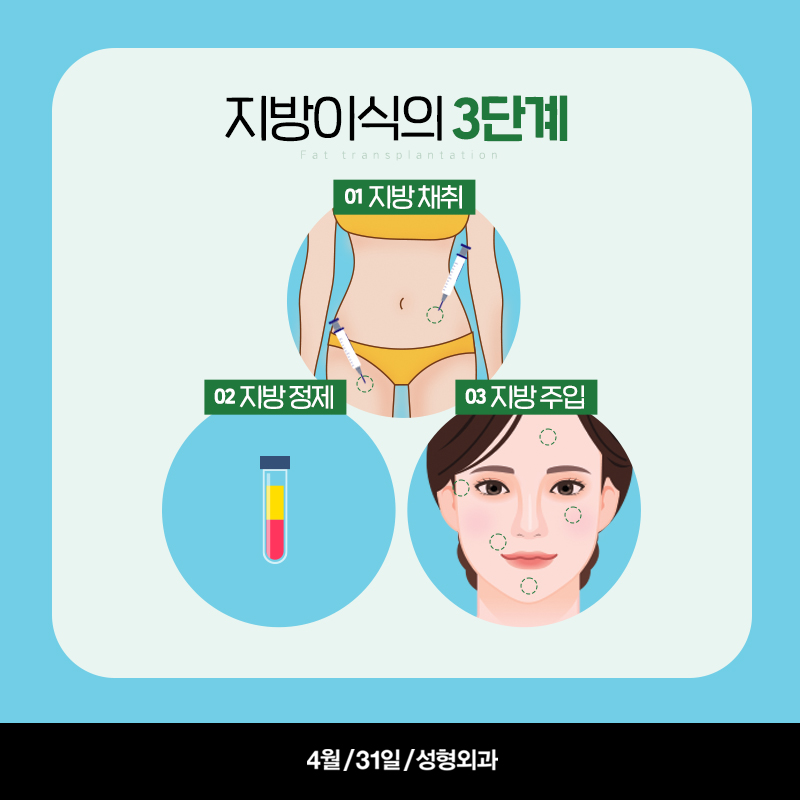 [안티에이징] 지방이식 그것이 알고싶다! 관련 이미지 3