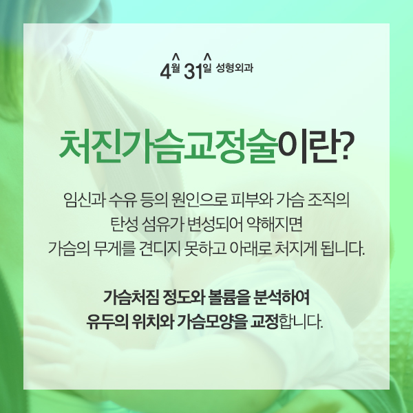 모유수유가슴처짐 4월31일성형외과 관련 이미지 2