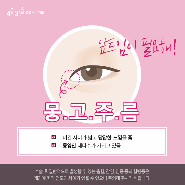 쌍커풀앞트임 흉터걱정없는 4월31일성형외과에서 관련 이미지 3