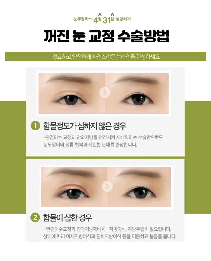 Sunken Eye Correction, April 31 Eyelid Volume Up: Bring Sunken Eyes Back to Life image 7