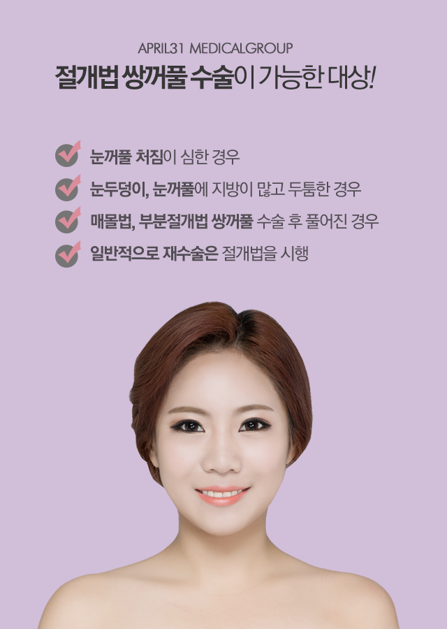 눈쌍커풀수술 흉터 적은 4월31일성형외과의원 관련 이미지 1