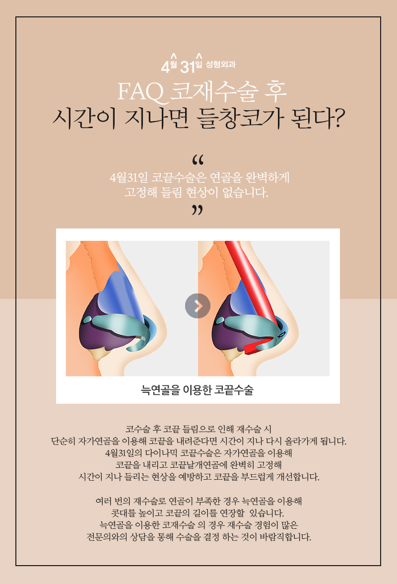 코재수술가격 이곳을 선택한 이유 관련 이미지 4