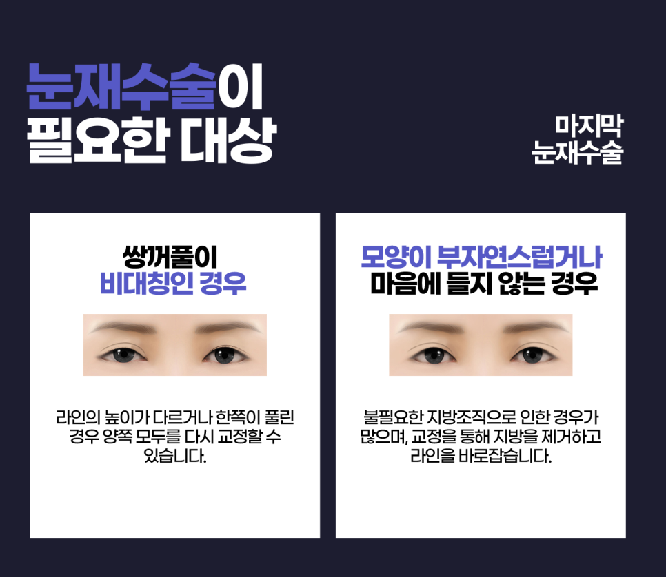 Because Revision Eye Surgery Is More Difficult Than the First, Start at April 31 Plastic Surgery image 5