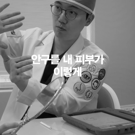 [April 31 Plastic Surgery] Does the outer corner eye surgery really reattach? image 5