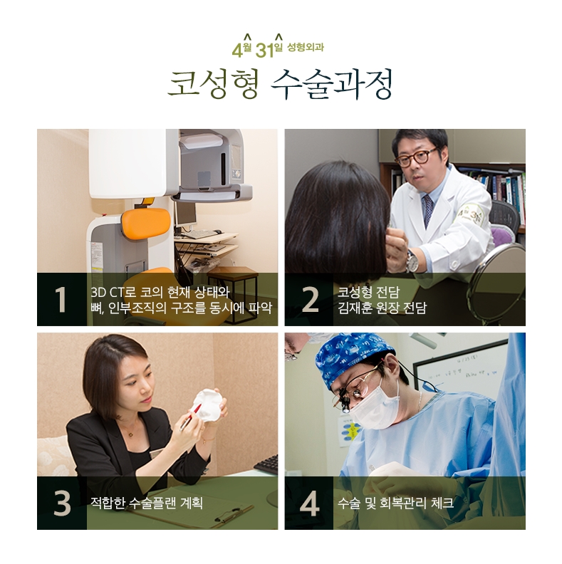 코재수술잘하는병원 4월31일성형외과의 만족감! 관련 이미지 5