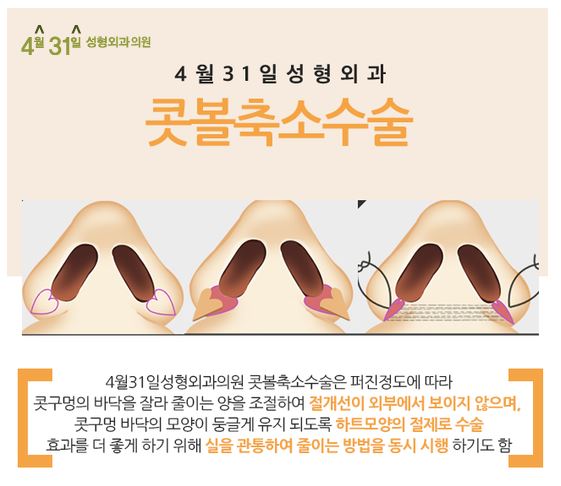 콧볼축소술 4월31일성형외과 관련 이미지 3