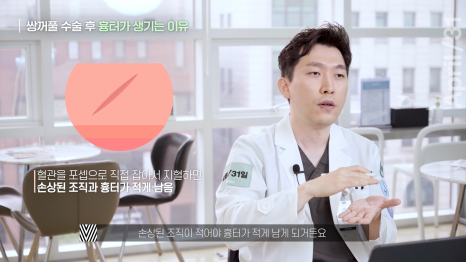 [Eye Plastic Surgery] The Dark and Light Sides of Eye Plastic Surgery - About Scars from Double Eyelid Surgery image 6