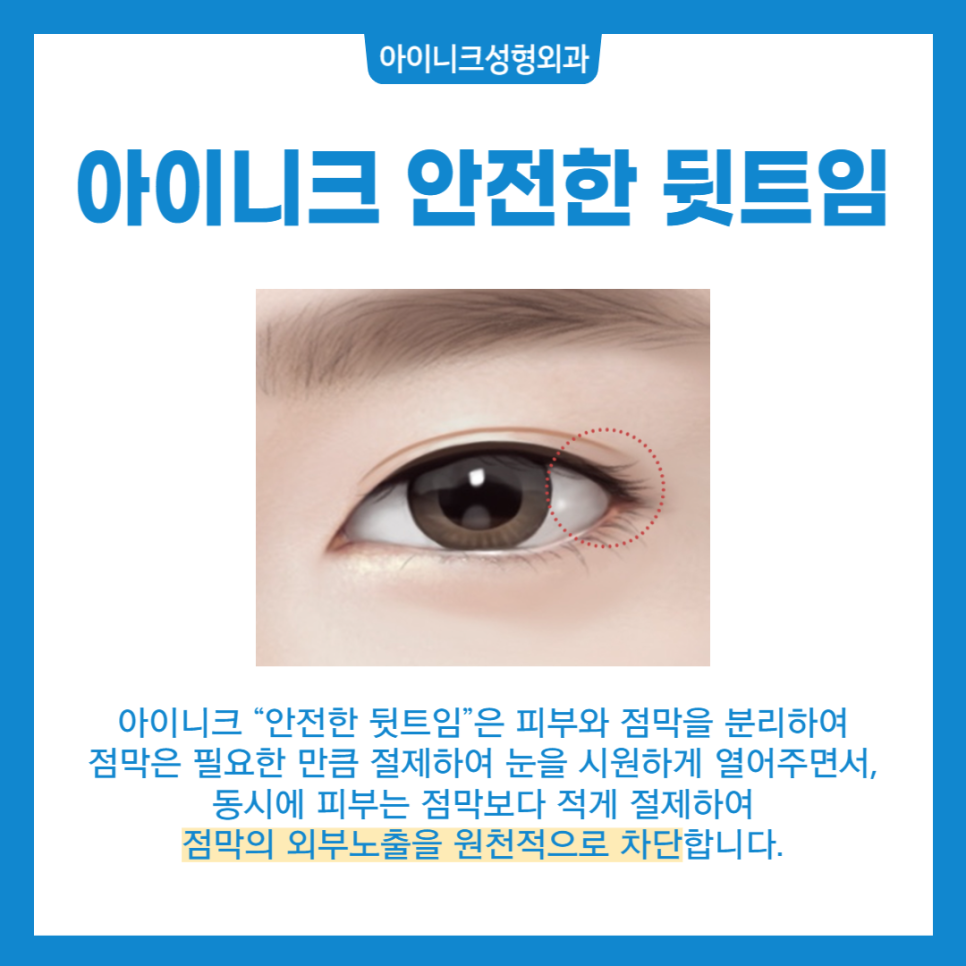 뒤트임 밑트임에 대해 알아보자! 관련 이미지 4