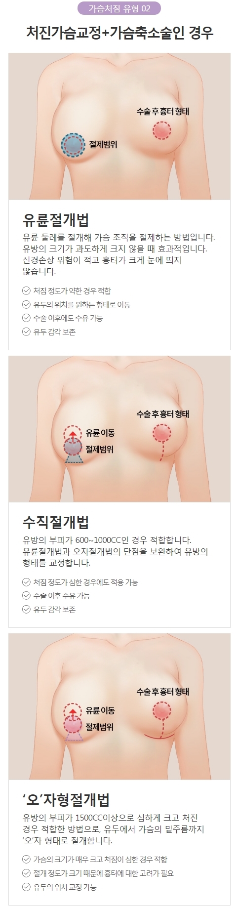 처진가슴수술비용 정확하고 꼼꼼한 맞춤 상담! 아이니크 성형외과! 관련 이미지 4