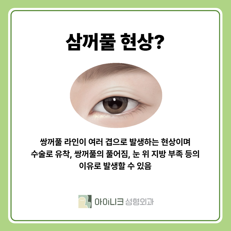 강남 쌍수재수술 필요한 경우와 꼼꼼함의 중요성 관련 이미지 7
