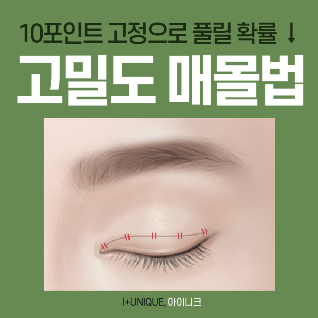 수험생들 모두 모여라! 쌍수절개법, 매몰법 할인 이벤트 진행 중 관련 이미지 4