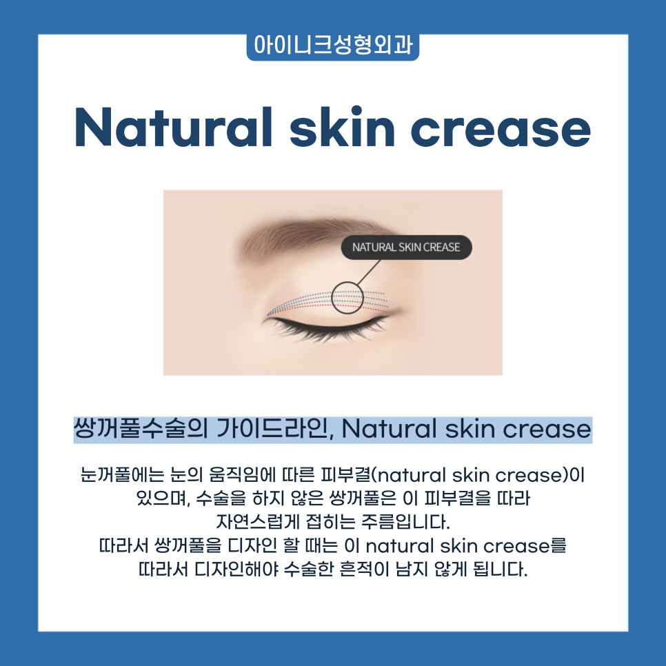 Where to Get Natural and Skillful Eyelid Surgery in Gangnam image 5