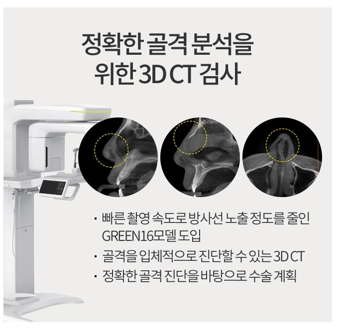 남자화살코성형 이상적인 비율로 변신! 관련 이미지 6