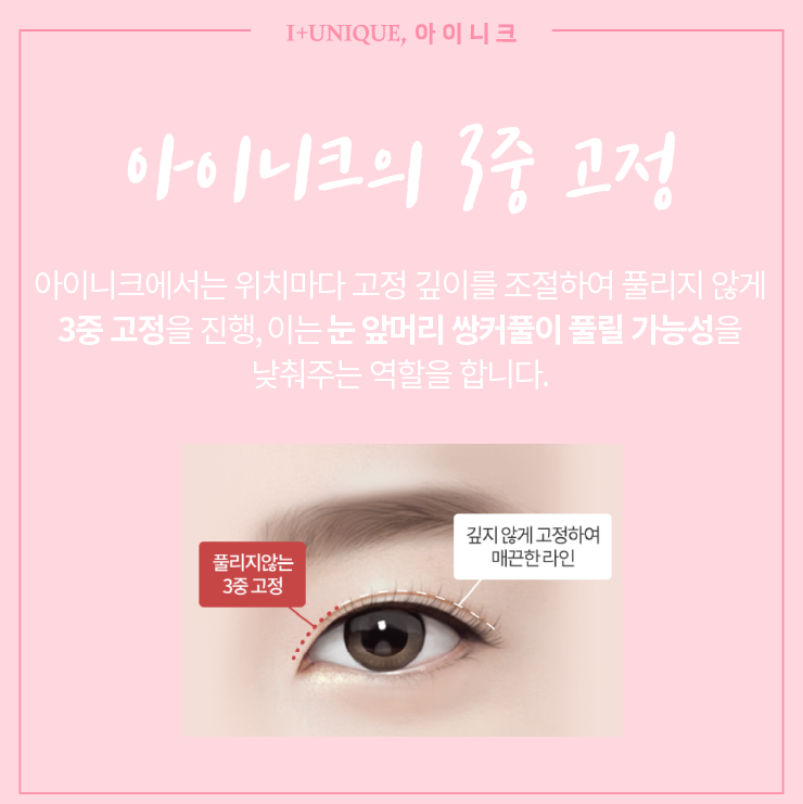 자연스러운 쌍꺼풀 이것만 알고하자! ㅇㅇㄴㅋ성형 관련 이미지 4