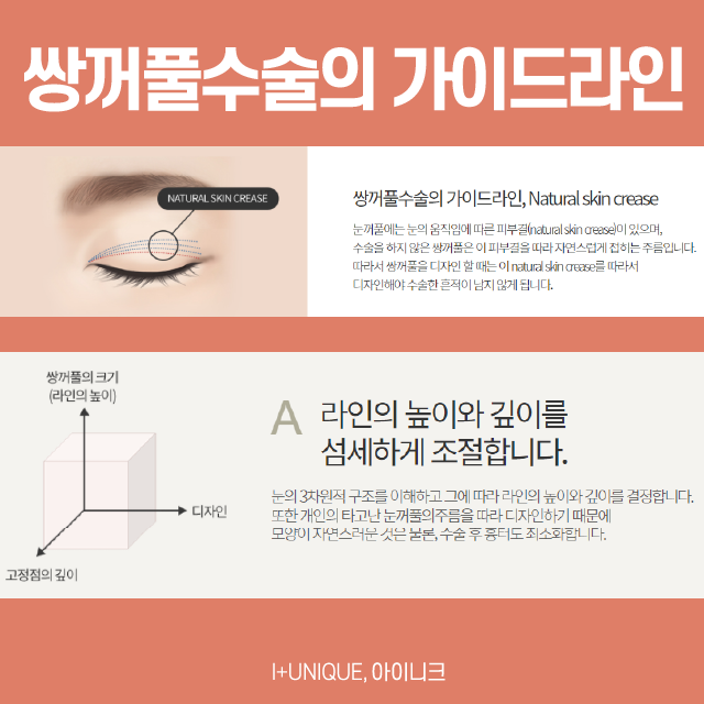 여자눈성형 가장 중요한 포인트는 이것 관련 이미지 5