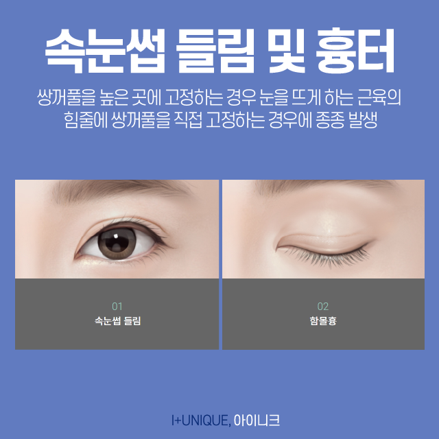 눈재수술성형외과를 알아보고 있다면 첫 수술부다 신중해야 한다 관련 이미지 4