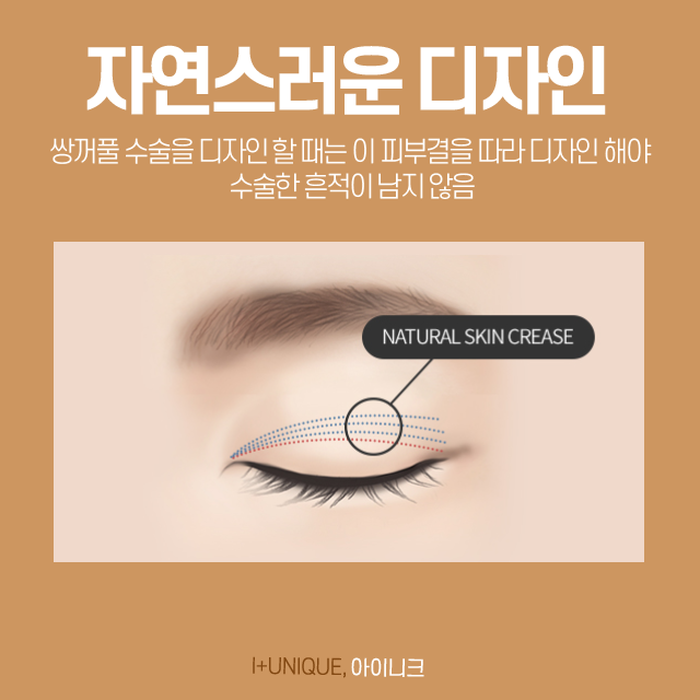 티안나는쌍꺼풀을 만들기 위해서는 신경써 주어야 할 것이 있습니다. 관련 이미지 5