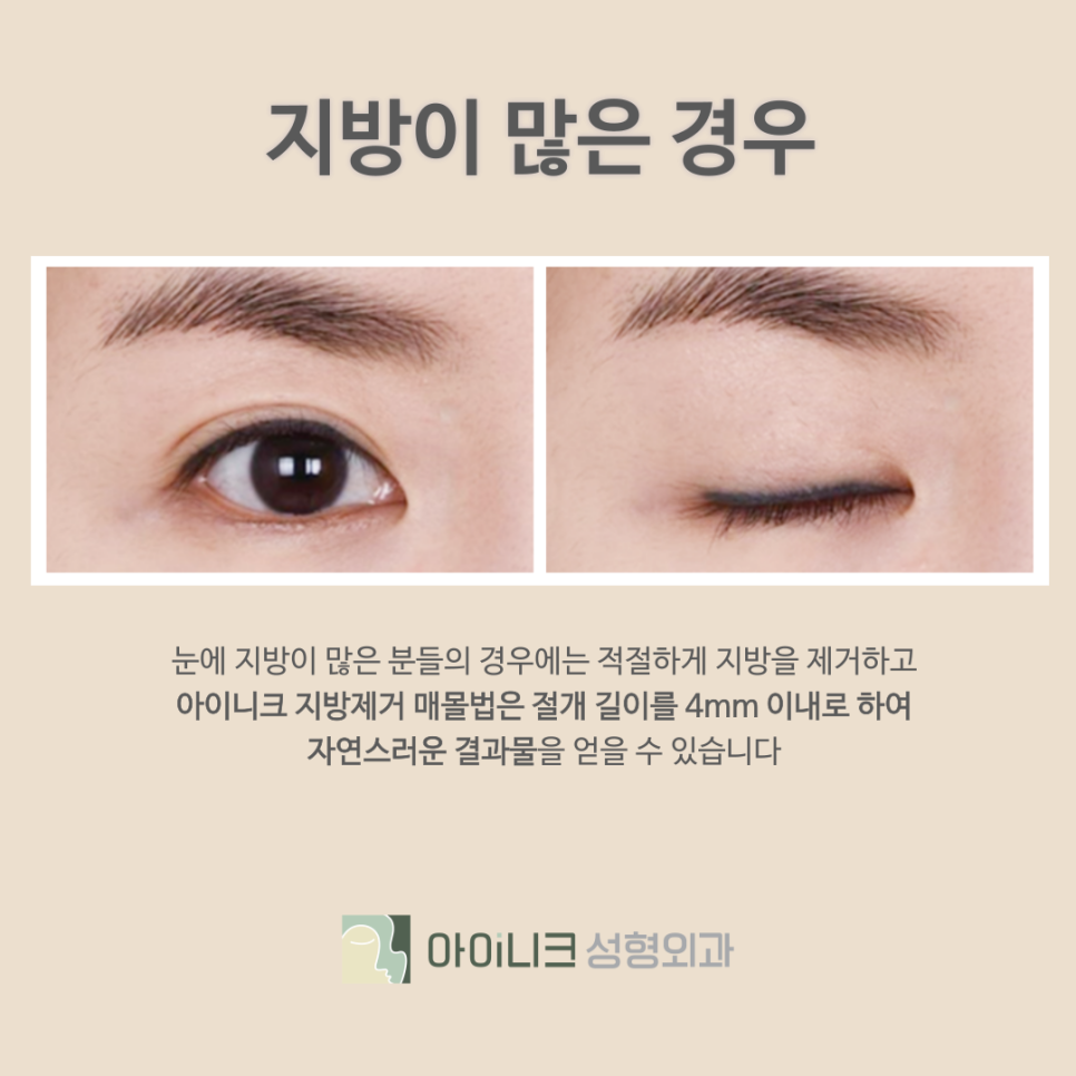 Why You Should Choose Aineek, a Plastic Surgery Clinic Near Apgujeong Station image 6