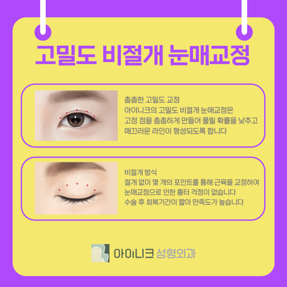 What Is the Non-Incisional Eye Correction Method at a Gangnam Eye Surgery Clinic? image 7
