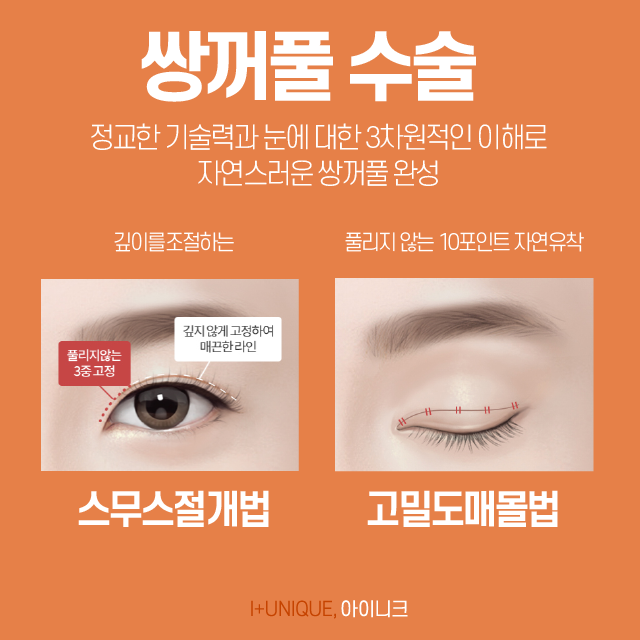 눈꺼풀수술, 종류도 다양하다! 아이니크에서 내 눈에 맞는 성형 알아보기 관련 이미지 2