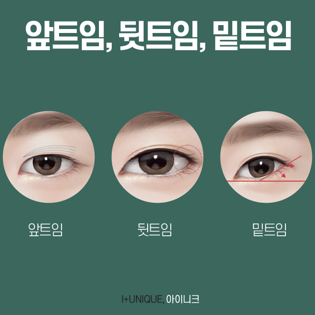 여자첫눈성형 A to Z 관련 이미지 3