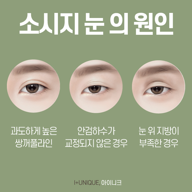 소시지눈주사로 간단하게 해결! 관련 이미지 2