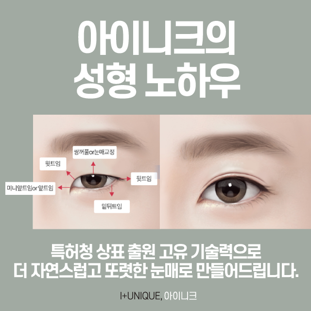 Learn About the Surgical Methods for Gangnam Epicanthoplasty and Eye Shape Correction image 2