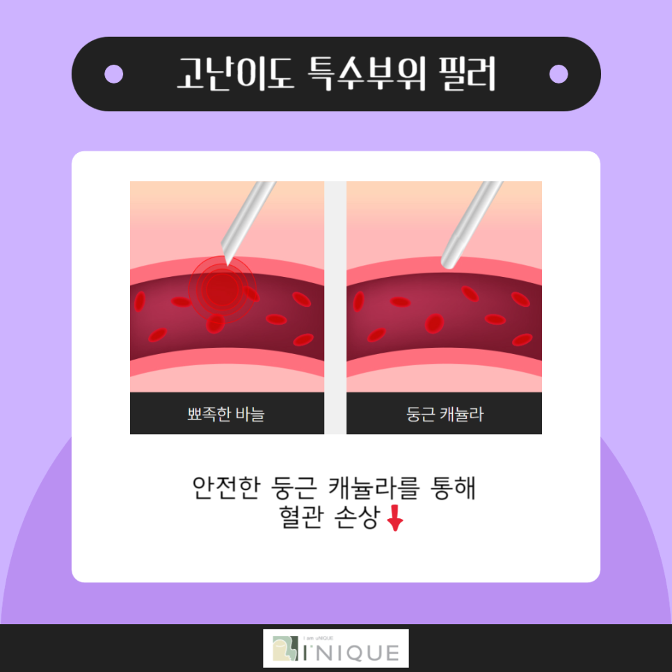이마필러잘하는곳은 무엇이 다를까 관련 이미지 4
