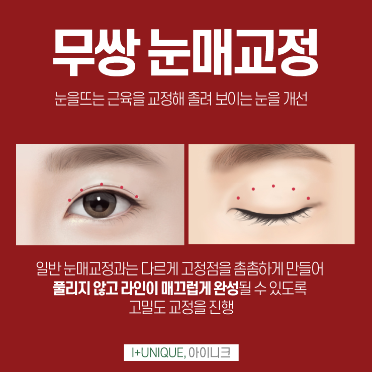 남자눈매교정병원은 더욱 신중해야한다 아이니크성형외과 관련 이미지 3