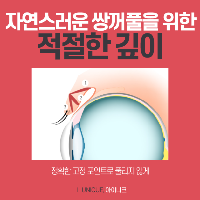 자연스러움을 결정하는 쌍수두께! 관련 이미지 4