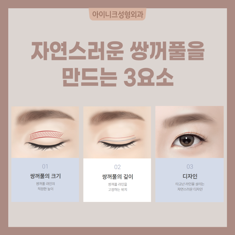 연예인눈성형처럼 자연스럽고 싶다면? 관련 이미지 2