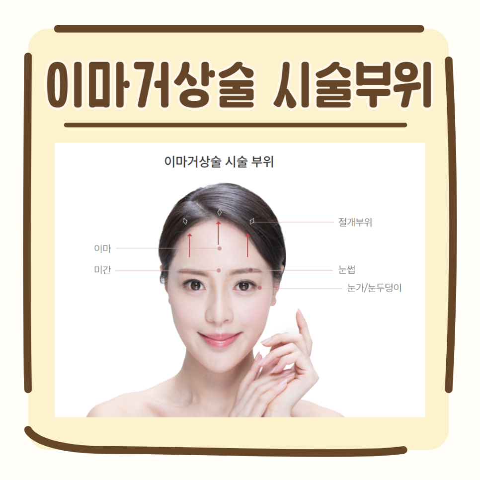 이마거상유명한곳, 이것이 달라요! 관련 이미지 2