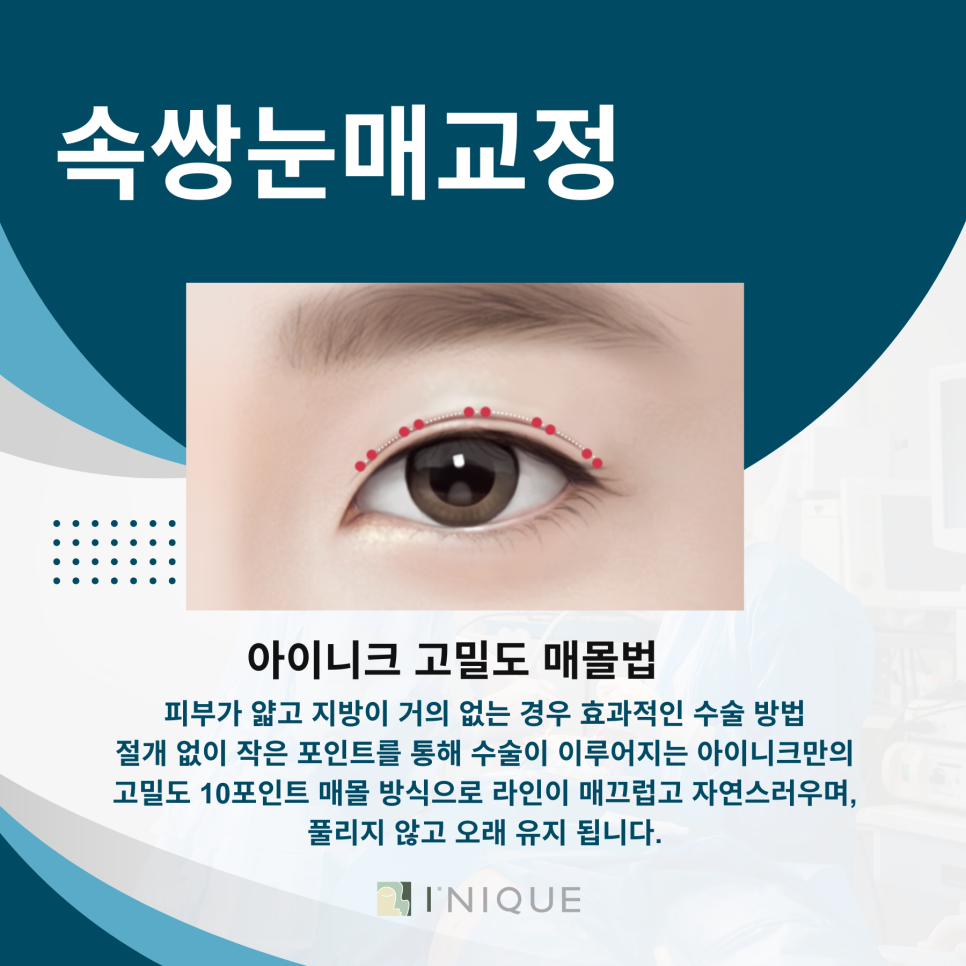 남자쌍꺼풀 잘하는곳 관련 이미지 5