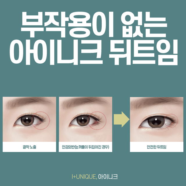 부작용 걱정없는 아이니크의 안전한 뒤트임 관련 이미지 3