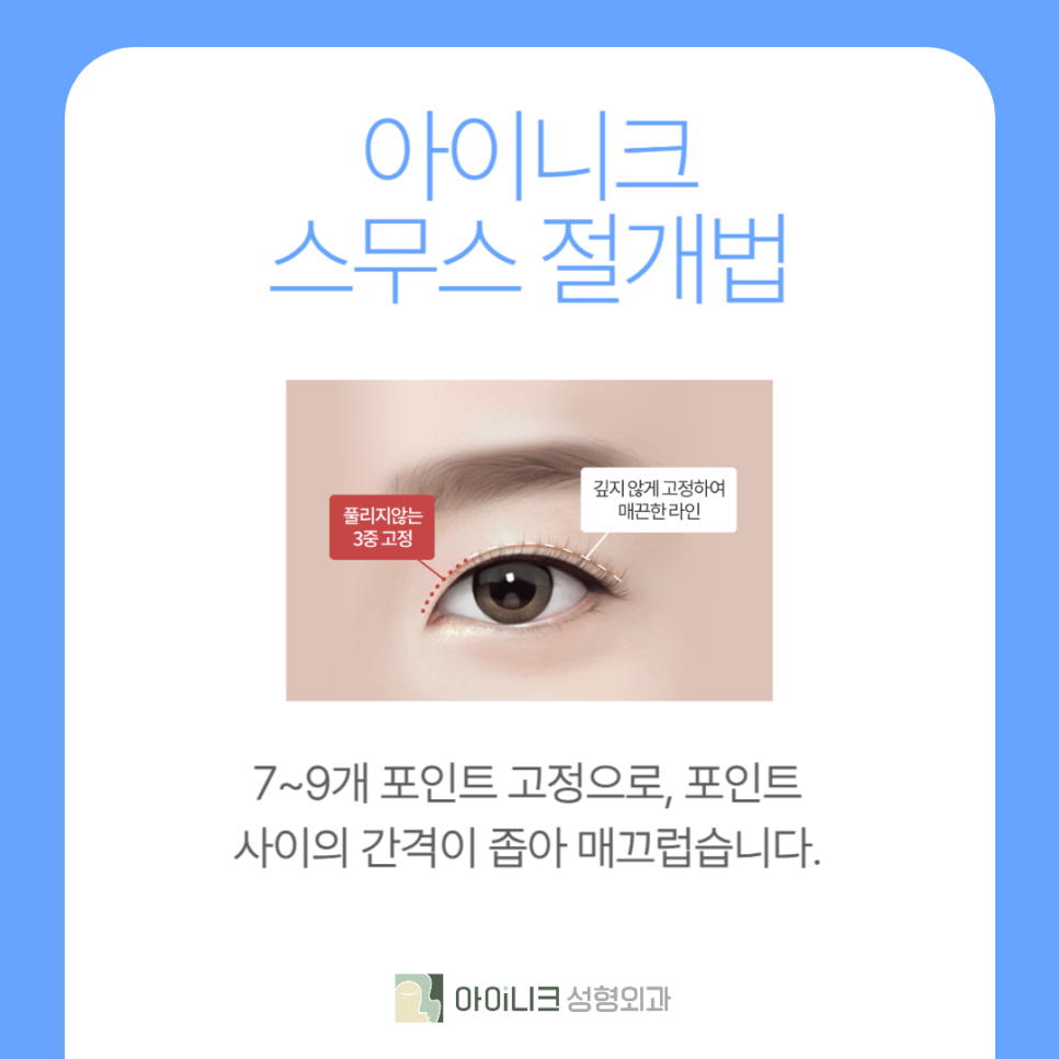 쌍커풀수술잘하는곳 나만의 눈매로 성공했어요 관련 이미지 5