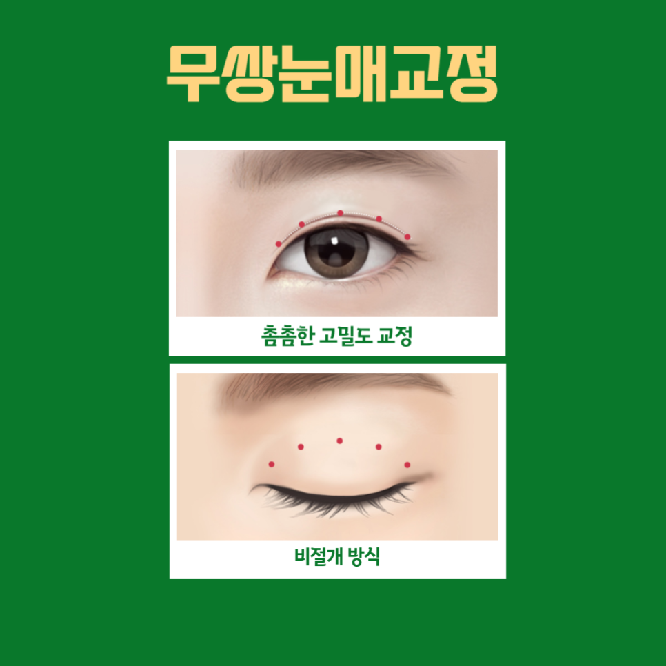 Points to Note for Male Eye Surgery image 4