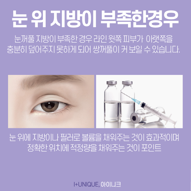 압구정쌍꺼풀재수술, 어떻게 하면 다시 자연스럽게 되돌릴 수 있을까 관련 이미지 5