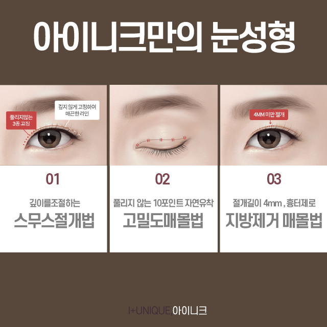 Apgujeong Double Eyelid Surgery Success, Inique’s Unique Technique image 2