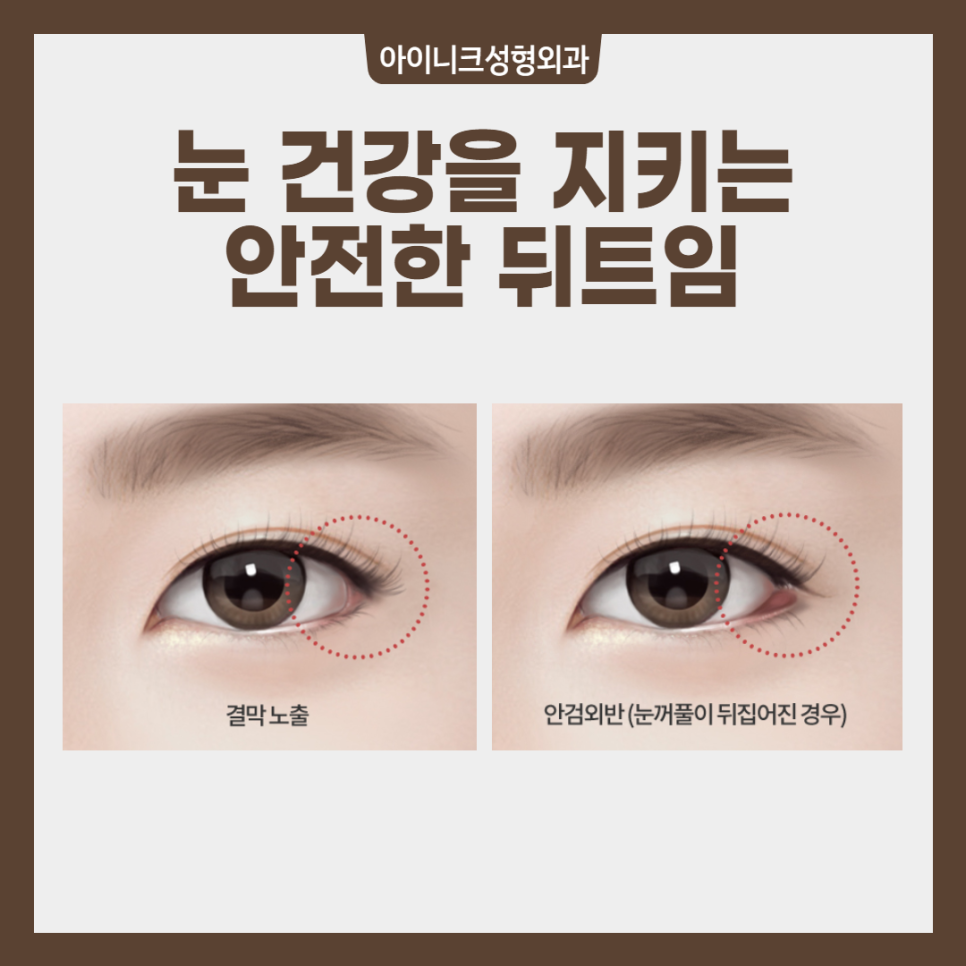 180도 이미지 변신? 압구정트임 수술 관련 이미지 4