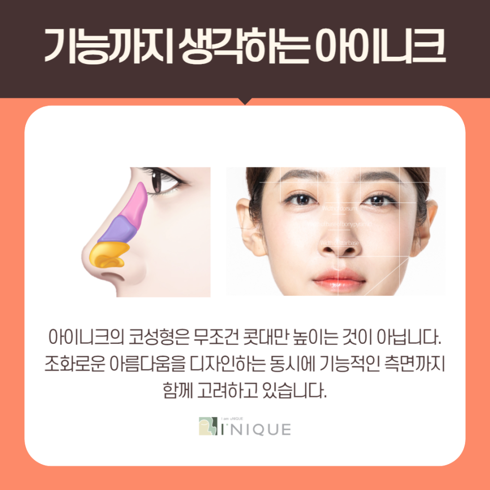복코성형외과 여기서 성공 관련 이미지 3