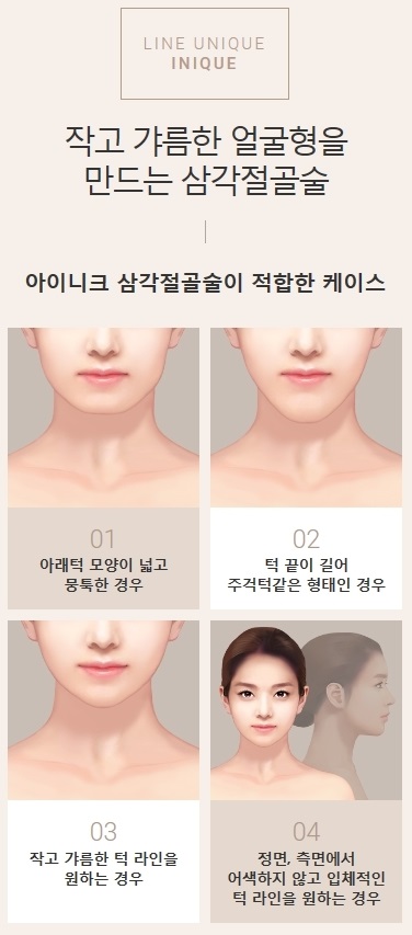턱끝축소술비용 세련된 내 모습 관련 이미지 2