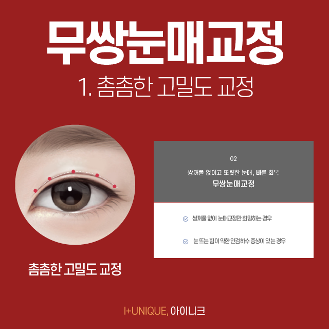 If You Want Natural, Clear Double Eyelids? Male Double-Eyelid Eye Correction Is the Answer! image 5