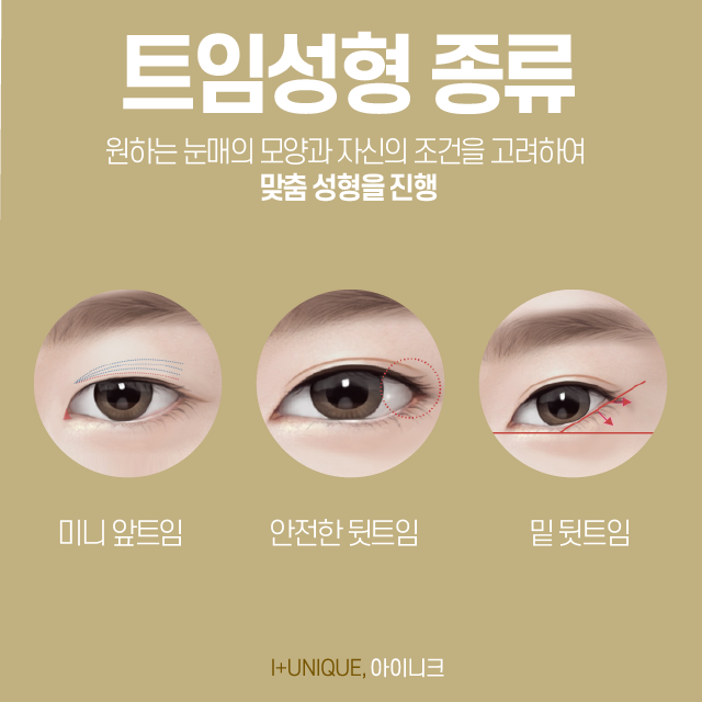 눈성형외과유명한곳 그 중, 자연스러운 트임을 원한다면? 관련 이미지 2