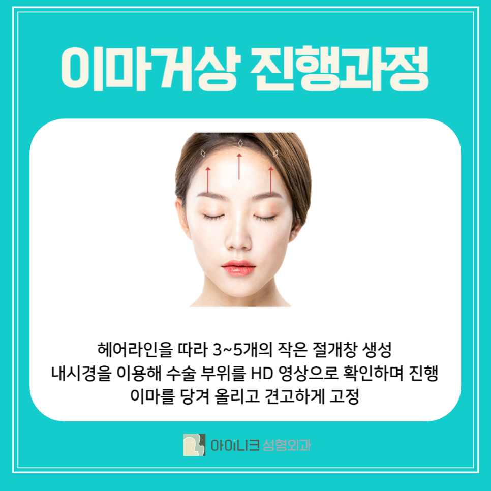 이마거상술잘하는곳, 여기서 관련 이미지 3