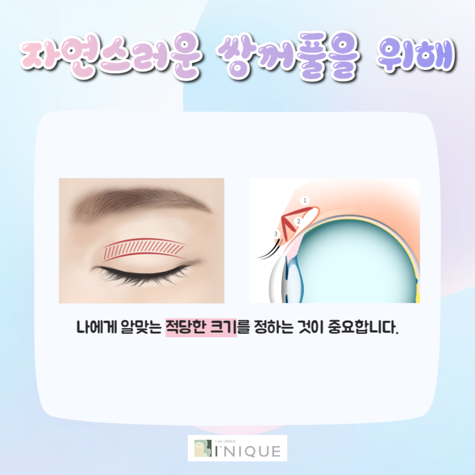 자연스러운쌍꺼풀을 위한 원칙 3가지 관련 이미지 3