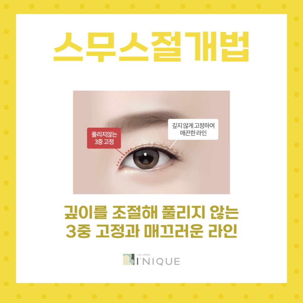 If you want to know where to find the best place for double eyelid surgery in Gangnam image 3