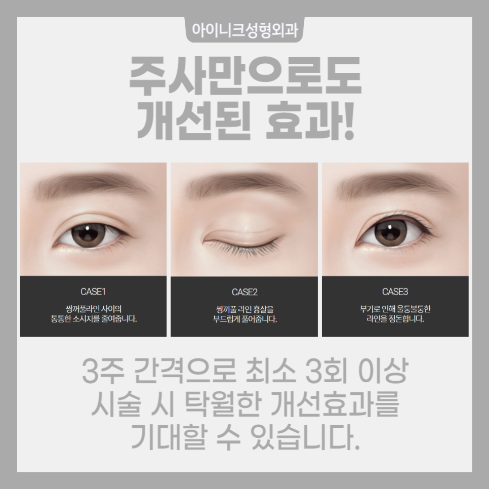 쌍수붓기주사로 간편하게 해결! 관련 이미지 5